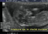 Echo premier trimestre Dr Ahmed SKHIRI