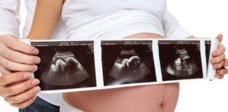 Echographie Gynecologie obstetrique