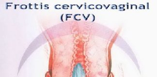 frottis cervicovaginal FCV Dr SKHIRI gynecologue