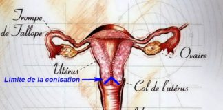 Conisation anatomie Dr SKHIRI gynecologue
