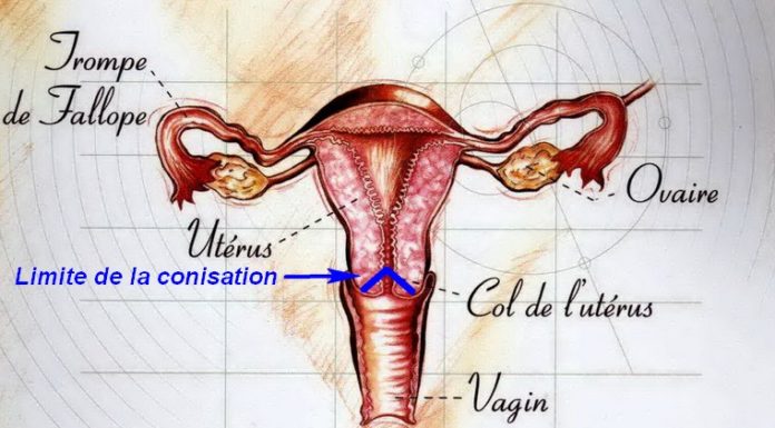 Conisation anatomie Dr SKHIRI gynecologue