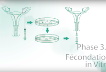 Fécondation In vitro