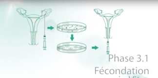 Fécondation In vitro