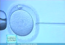 Tout savoir sur la fécondation in vitro 2