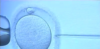 Tout savoir sur la fécondation in vitro 2
