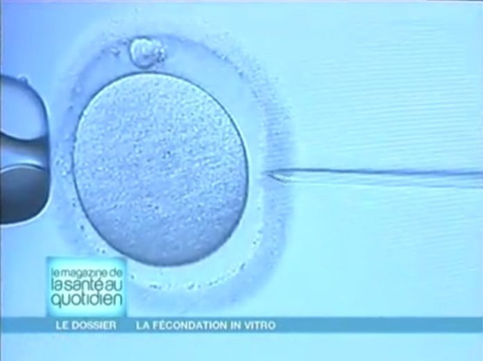 Tout savoir sur la fécondation in vitro 2