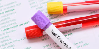 test trisomie 21