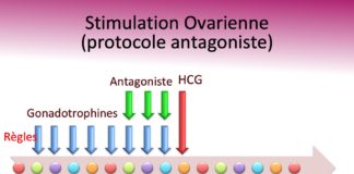 Protocole antagoniste Dr Ahmed SKHIRI