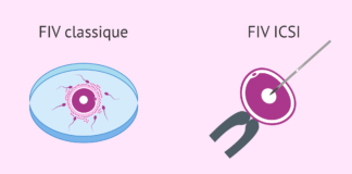 Differences entre FIV classique et ICSI