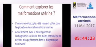 Comment explorer les malformations utérines Dr Ahmed SKHIRI 2017