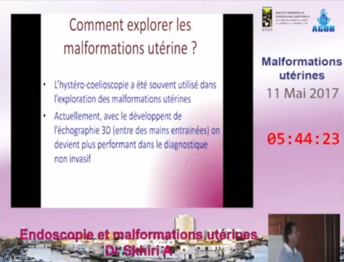 Comment explorer les malformations utérines Dr Ahmed SKHIRI 2017