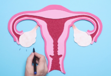 Insémination intra Uterine (IIU)