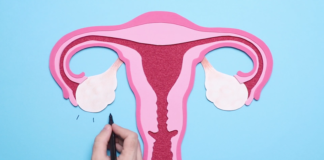 Insémination intra Uterine (IIU)